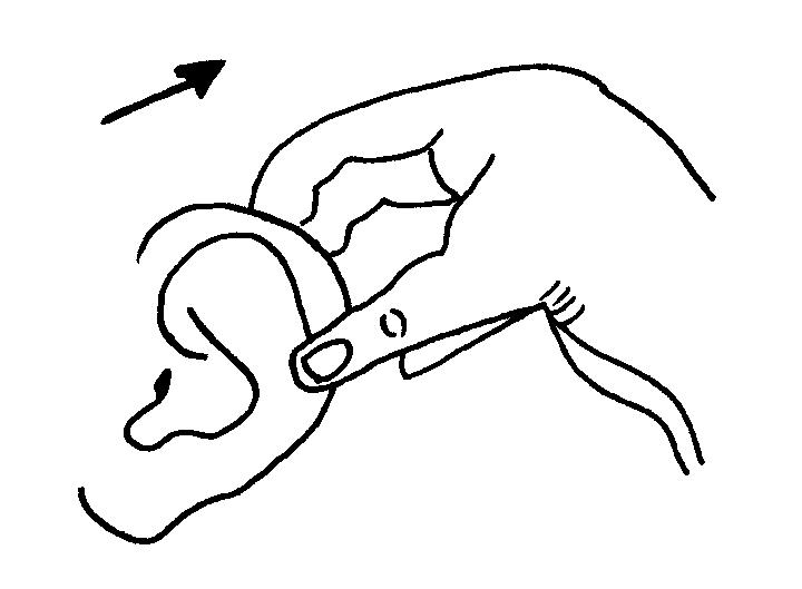 Ear Care Diagram
